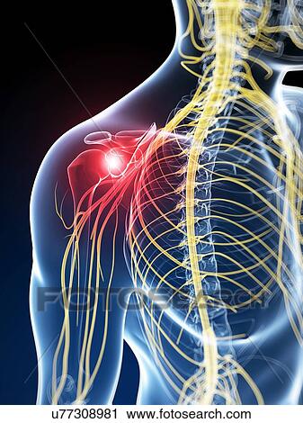 Human nerve pain, artwork View Large Illustration Clip Art - Human nerve pain, artwork. Fotosearch