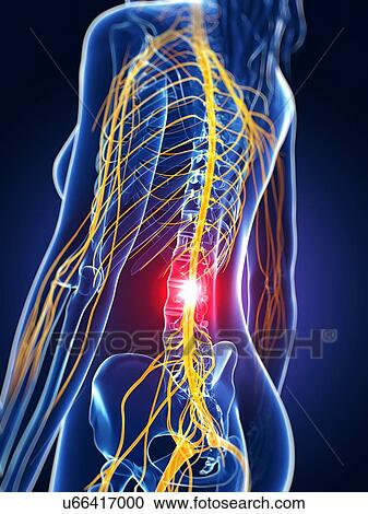 Human nerve pain, artwork View Large Illustration Clipart - Human nerve pain, artwork. Fotosearch