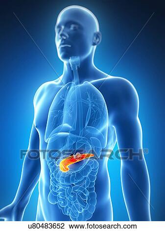 Human pancreas showing tumor, artwork View Large Illustration Drawing - Human pancreas showing tumor, artwork. Fotosearch