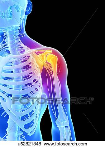 Human shoulder nerves, artwork View Large Illustration Stock Illustration - Human shoulder nerves, artwork. Fotosearch