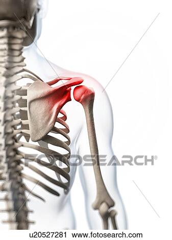 Human shoulder pain, artwork View Large Illustration Clip Art - Human shoulder pain, artwork. Fotosearch