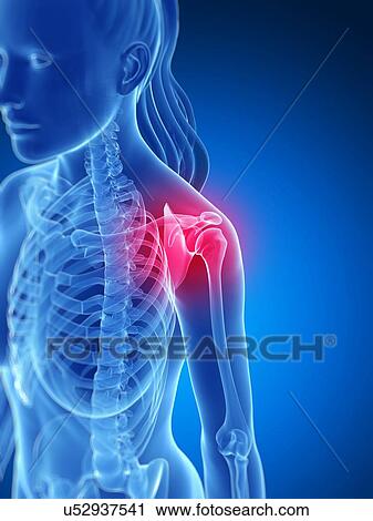 Human shoulder pain, artwork View Large Illustration Clip Art - Human shoulder pain, artwork. Fotosearch