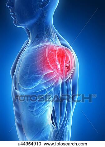 Human shoulder pain, artwork View Large Illustration Clipart - Human shoulder pain, artwork. Fotosearch