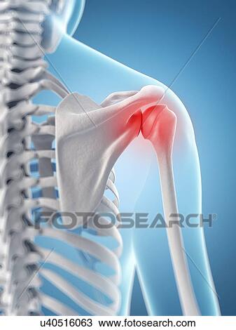 Human shoulder pain, artwork View Large Illustration Drawing - Human shoulder pain, artwork. Fotosearch