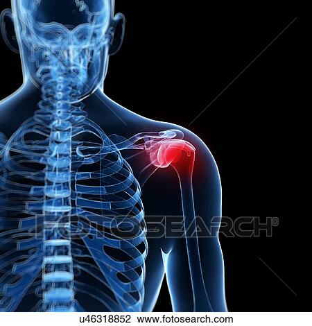 Human shoulder pain, artwork View Large Illustration Drawing - Human shoulder pain, artwork. Fotosearch