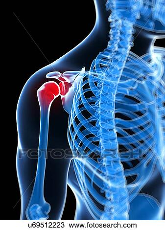 Human shoulder pain, artwork View Large Illustration Drawing - Human shoulder pain, artwork. Fotosearch