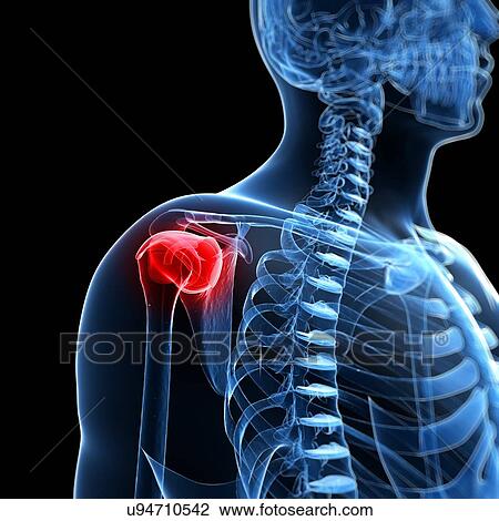 Human shoulder pain, artwork View Large Illustration Drawing - Human shoulder pain, artwork. Fotosearch
