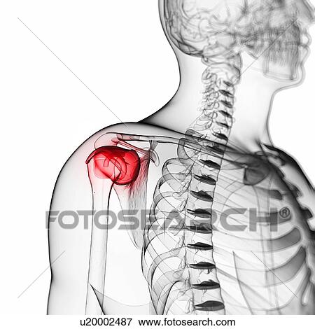 Human shoulder pain, artwork View Large Illustration Stock Illustration - Human shoulder pain, artwork. Fotosearch