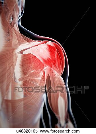 Human shoulder pain, artwork View Large Illustration Stock Illustration - Human shoulder pain, artwork. Fotosearch
