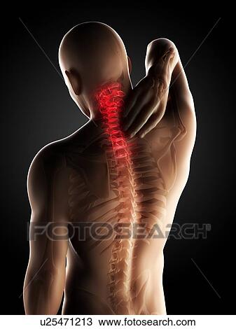 Human spine pain, artwork View Large Illustration Drawing - Human spine pain, artwork. Fotosearch