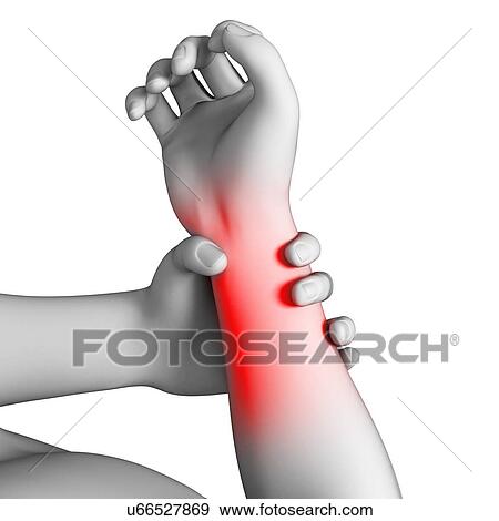 Human wrist pain, artwork View Large Illustration Stock Illustration - Human wrist pain, artwork. Fotosearch