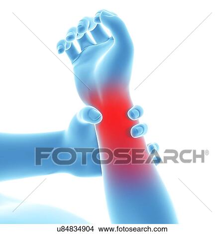 Human wrist pain, artwork View Large Illustration Stock Illustration - Human wrist pain, artwork. Fotosearch