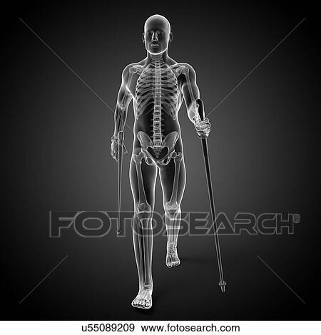 Nordic walker, artwork View Large Illustration Stock Illustration - Nordic walker, artwork. Fotosearch