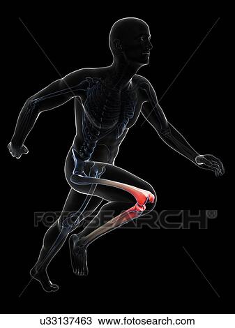 Runner's knee joint, artwork View Large Illustration Drawing - Runner's knee joint, artwork. Fotosearch