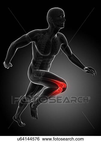 Stock Illustration - Runner's knee joint, artwork. Fotosearch