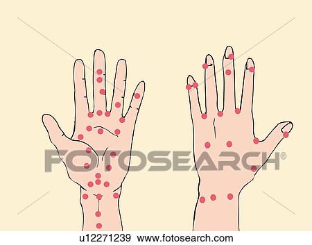 Acupressure ポイント の 手 終わり 高い 角度 眺め イラスト U Fotosearch