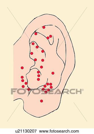 Acupressure ポイント の 耳 終わり 正面図 イラスト U Fotosearch