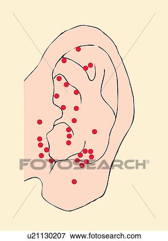 Acupressure points of ears, close up, front view View Large Illustration Stock Illustration - Acupressure points of ears, close up, front view. Fotosearch