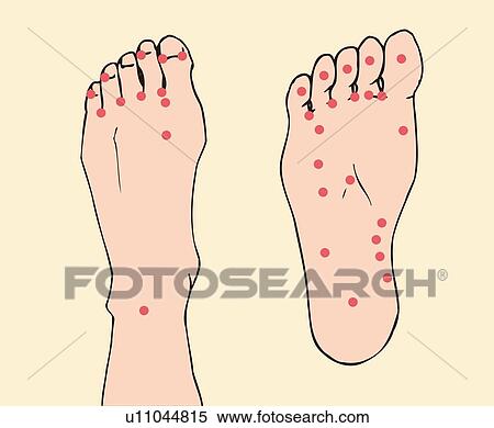 Stock Illustration - Acupressure points of feet, close up. Fotosearch