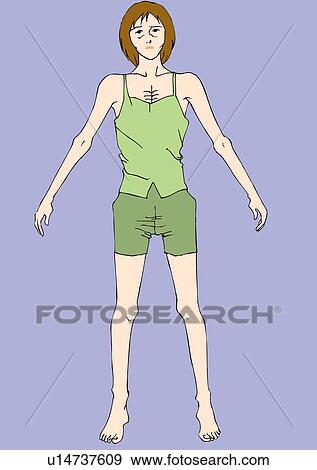 Stock Illustration - Woman standing with emaciated body, front view. Fotosearch