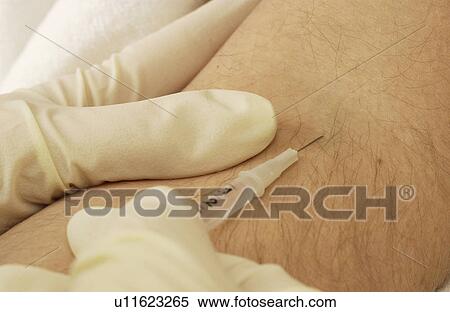 Stock Photography - Man getting a shot. Fotosearch