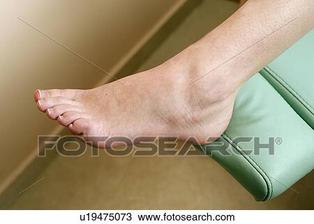 A foot ready for a pedicure View Large Photo Image Stock Image - A foot ready for a pedicure. Fotosearch