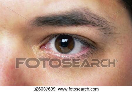 Stock Photo - Mans face. Fotosearch