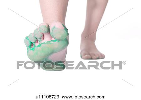 Feet showing green on the underside View Large Photo Image Stock Photo - Feet showing green on the underside. Fotosearch
