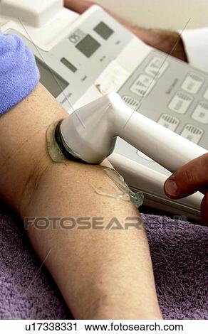 Stock Image - Woman in physical therapy. Fotosearch