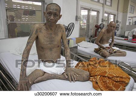 aids, person, patients, hiv, thailand, people View Large Photo Image Stock Photo - aids, person, patients, hiv, thailand, people. Fotosearch