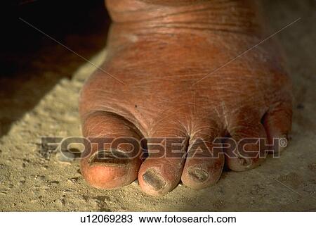 foot, ifugao, leathred, shows, females, women View Large Photo Image Stock Image - foot, ifugao, leathred, shows, females, women. Fotosearch