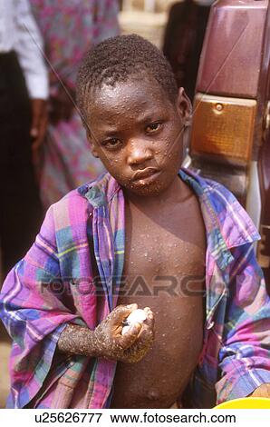 Stock Photo - full, person, boy, uganda, 3266, people. Fotosearch