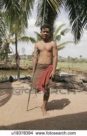 person, one, handicapped, male, people View Large Photo Image Picture - person, one, handicapped, male, people. Fotosearch