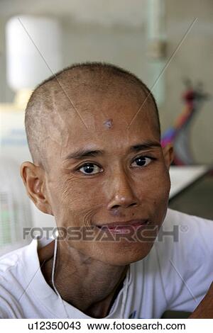 Stock Image - aids, person, patients, hiv, thailand, people. Fotosearch