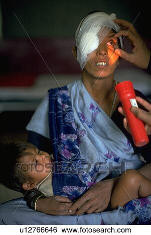 Stock Photograph - mother, hand, bhopal, kid, child, medical. Fotosearch