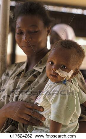 malnourished, child, faso, burkina, person, people View Large Photo Image Stock Image - malnourished, child, faso, burkina, person, people. Fotosearch