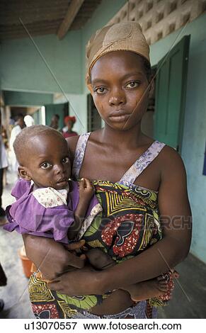 malnourished, people, benin, person, child, woman View Large Photo Image Stock Photo - malnourished, people, benin, person, child, woman. Fotosearch