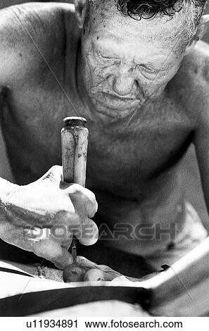 white, bw, surinam, leprosy, black View Large Photo Image Stock Image - white, bw, surinam, leprosy, black. Fotosearch