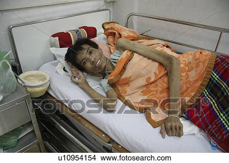 aids, person, patients, hiv, thailand, people View Large Photo Image Picture - aids, person, patients, hiv, thailand, people. Fotosearch