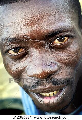 black, portrait, scar, male, addicted View Large Photo Image Picture - black, portrait, scar, male, addicted. Fotosearch