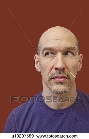 Close-up of a mature man with acupuncture needles on face while looking away View Large Photo Image Stock Photo - Close-up of a mature man with acupuncture needles on face while looking away. Fotosearch