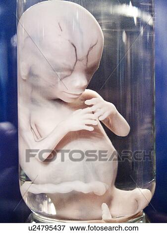 What does a 12 week old human fetus look like 1
