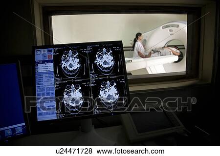 Stock Photo - MRI results on a computer . Fotosearch