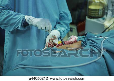 Surgeon performing an operation View Large Photo Image Stock Image - Surgeon performing an operation . Fotosearch