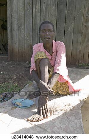 Irene", infected with HIV/AIDS, sits on ground at the Pepo La Tumaini Jangwani, HIV/AIDS Community Rehabilitation Program, Orphanage & Clinic. Pepo La Tumaini Jangwani (wind of hope in the arid place) offers hope, support and care for orphan and vulnerab View Large Photo Image Stock Photo - Irene", infected with HIV/AIDS, sits on ground at the Pepo La Tumaini Jangwani, HIV/AIDS Community Rehabilitation Program, Orphanage & Clinic. Pepo La Tumaini Jangwani (wind of hope in the arid place) offers hope, support and care for orphan and vulnerab. Fotosearch