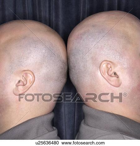 Close up of bald identical twin men standing back to back. View Large Photo Image Stock Image - Close up of bald identical twin men standing back to back.. Fotosearch