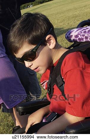 Close up image of a little boy with significant disabilities. View Large Photo Image Picture - Close up image of a little boy with significant disabilities.. Fotosearch