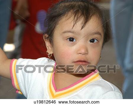 Stock Photograph - Adorable little girl with Down's syndrome.. Fotosearch
