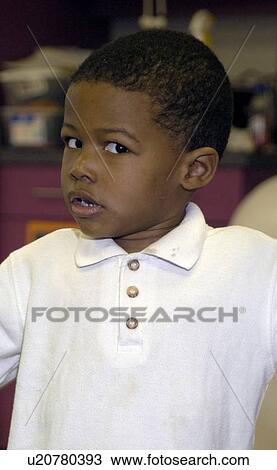 Little boy with disabilities with an expression on his face that lets you know he is a bit unsure of what is going on. View Large Photo Image Stock Image - Little boy with disabilities with an expression on his face that lets you know he is a bit unsure of what is going on.. Fotosearch