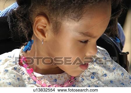 Little girl with multiple disabilities. View Large Photo Image Picture - Little girl with multiple disabilities.. Fotosearch